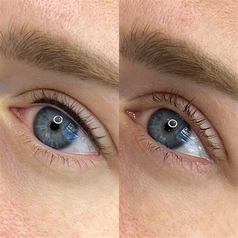 lash line 5