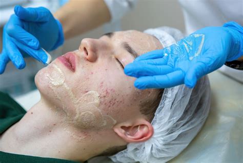 Acne Treatments in Ashland, Medford, and White City