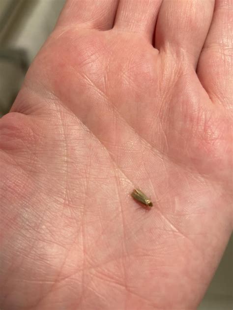 Clothes Moths? : r/melbourne
