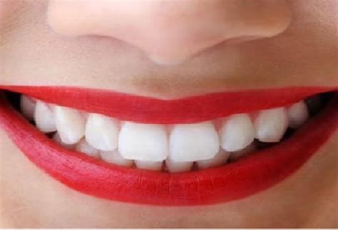 teeth  stained follow     teeth shiny