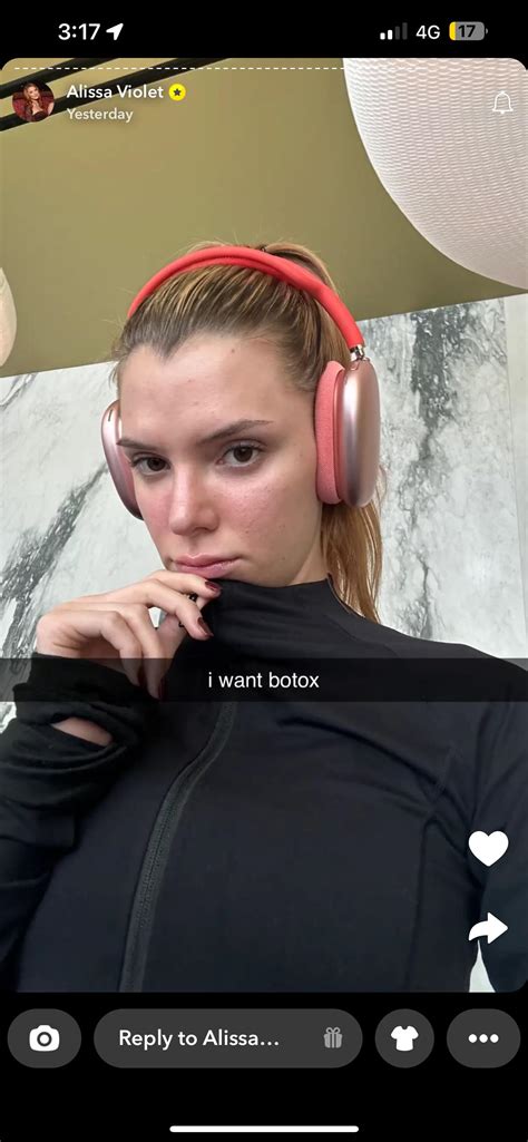 Does Alissa Violet NOT have Botox or are we calling bs? : r