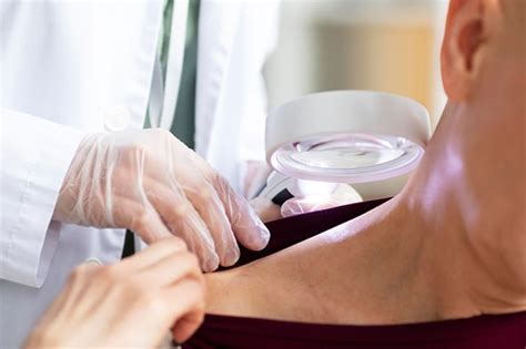 Melanoma Removal Surgery