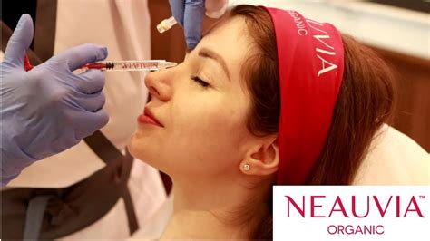 МОЯТ ОПИТ С ФИЛЪРИ ЗА ЛИЦЕ | Корекция на нос с NEAUVIA ORGANIC - YouTube
