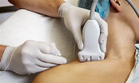 Ultrasound Guided Injections for Clarkston, MI | Clarkston Pain and ...