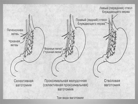 Оперативная хирургия желудка - online presentation