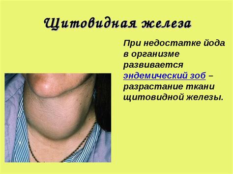 Желези - презентація з біології