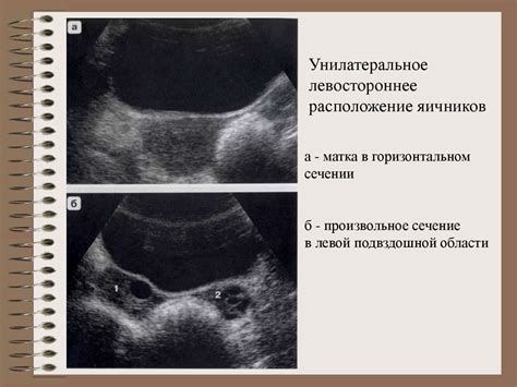 Детская гинекология - презентация онлайн