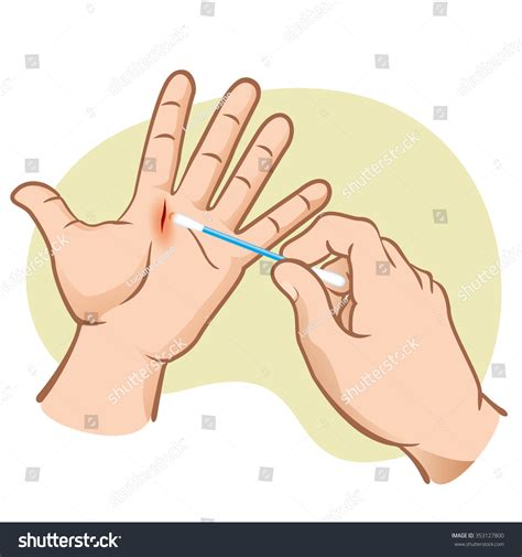 356 Wound cleaning vector Images, Stock Photos & Vectors | Shutterstock
