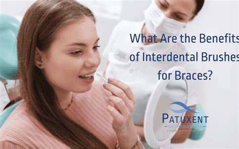 The 4 Stunning Benefits of Interdental Brushes for Braces!