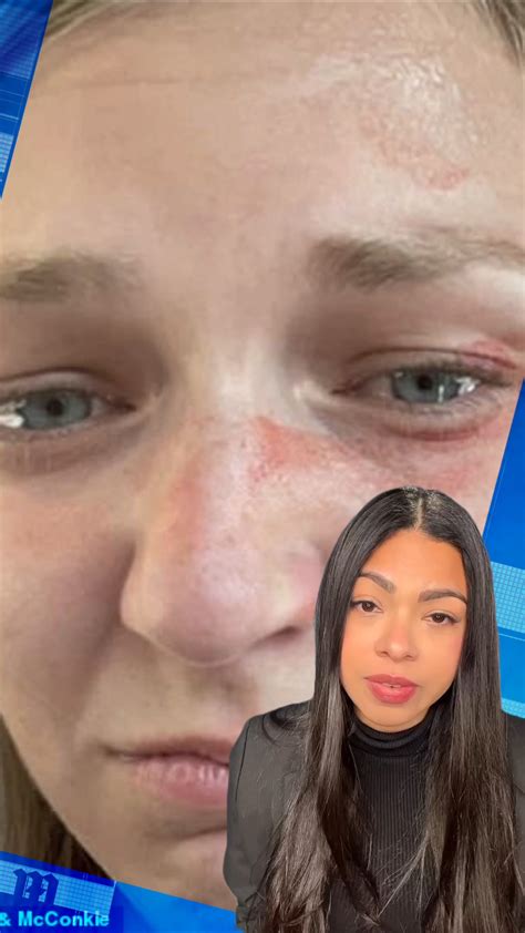 Selfie shows Gabby Petito’s injuries after she had been attacked by