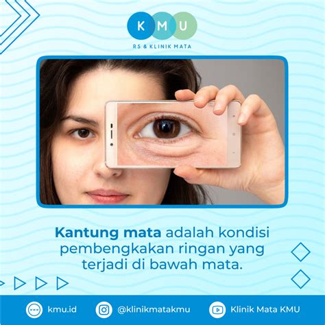 munculnya bekas luka operasi kantung mata  faktanya