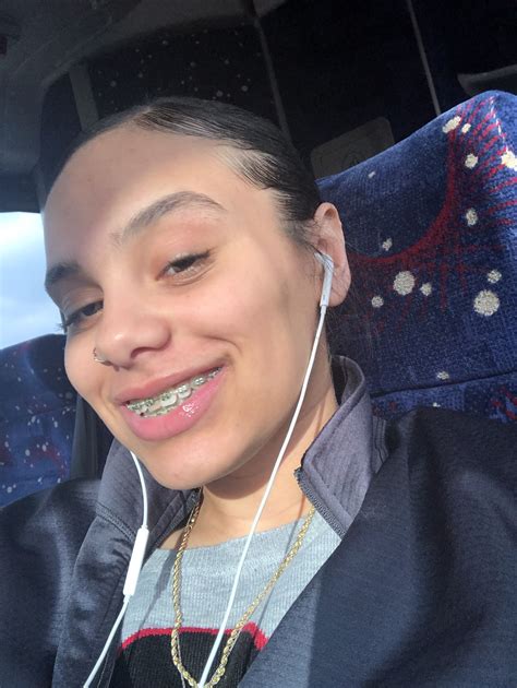 Pin on Light skin girls | Light skin girls, Cute braces, Light skin