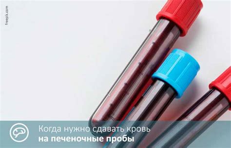 Печеночные пробы. Анализ крови. Что входит. Расшифровка, норма
