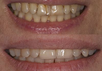 Портфолио - Стоматология Dental