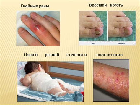 Бранолинд - презентация онлайн