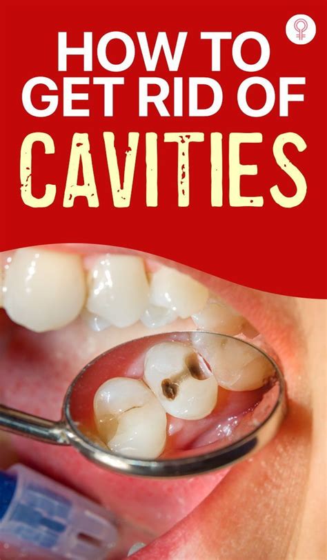 how to help cavities at home
