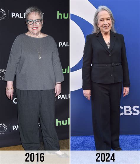 Kathy Bates Weight Loss - Her Inspiring Health Journey