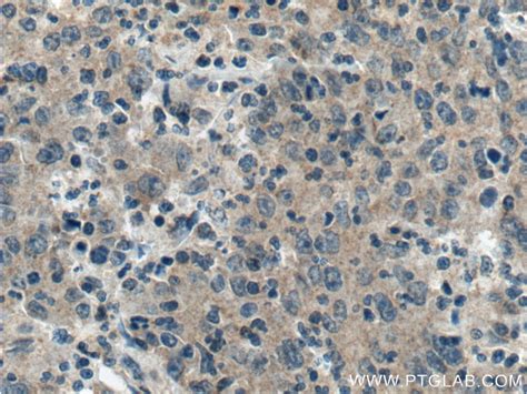 TMPRSS2 antibody (14437-1-AP) | Proteintech