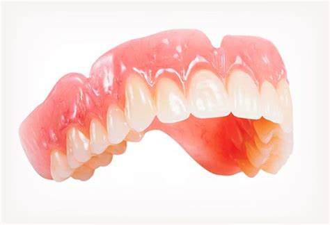 Временный зубной протез для людей лишившихся зубов | Dental Park