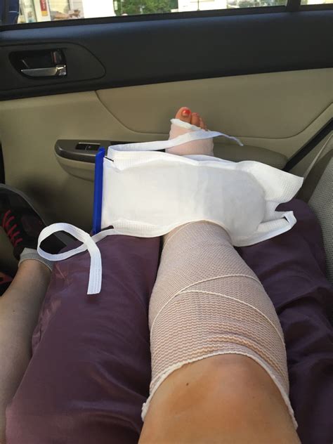 Ten tips for the woman in a leg cast – Artofit
