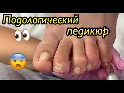 Подологический педикюр🦶🏻👀😧 - YouTube