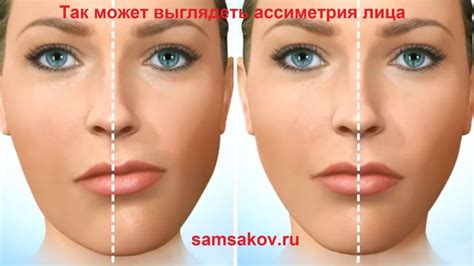 Асимметрия лица: причины, последствия и возможности коррекции | Альянс ...