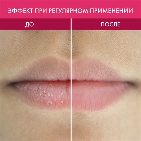 Купить Сахарный скраб для губ Strawberry Lips Scrub Skinphoria на ...