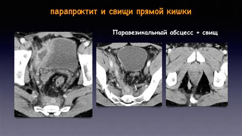 Визуализация прямой кишки и перианальной области