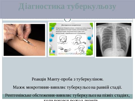 Презентація з теми "Туберкульоз та його профілактика"