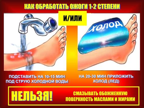 Ожог кипятком, лечение в домашних условия, лекарство и народные методы ...
