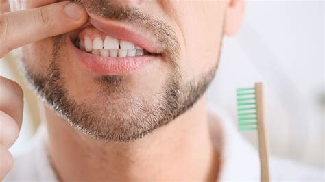 understanding plaque  teeth lloydspharmacy