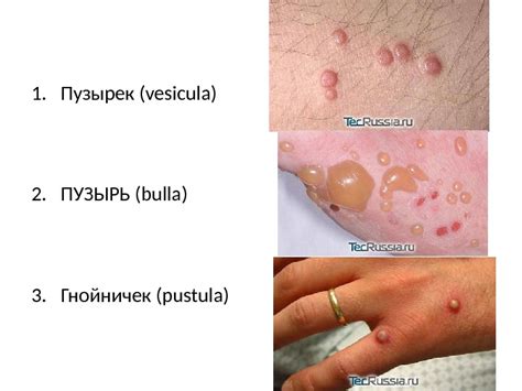 Презентация Кожные заболевания и их профилактика