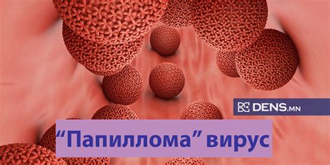 "Папиллома" вирусийг хэрхэн оношлох вэ? » Dens.mn - Популизмаас ангид ...