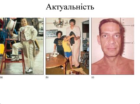 Ендокринний апарат - online presentation