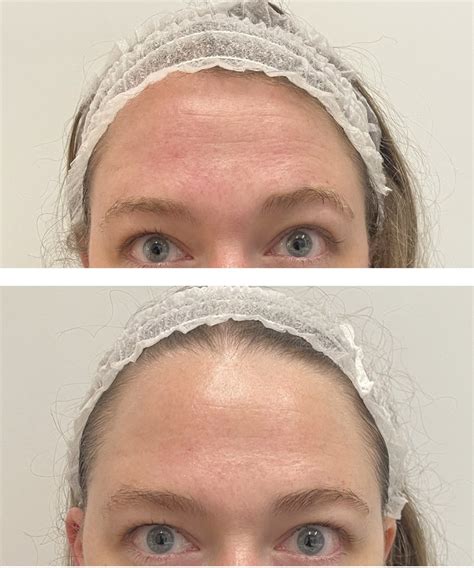 Enhance Your Skincare Routine with Gua Sha Face Massage: Expert Tips