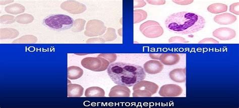 Сегментоядерные нейтрофилы – норма, понижены, повышены. Что такое ...