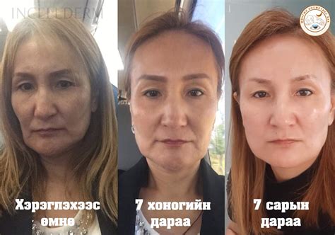 Бодит үр дүн, Бодит зураг