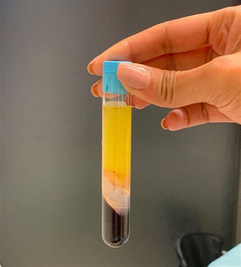 Natural Skin Rejuvenation London > Face Treatments > Bodyvie