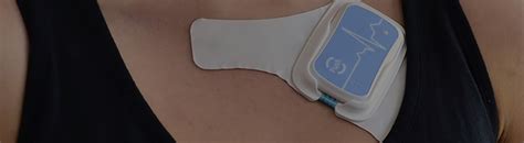 Posicionamento Eletrodo Ecg 2