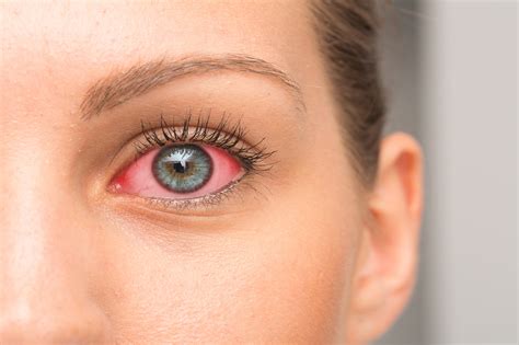 Gouttes Pour Les Yeux Contre Le Glaucome