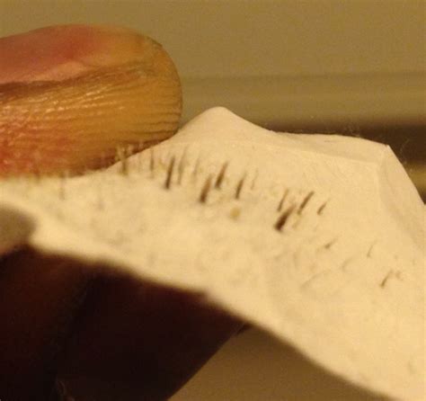 17 Oddly Satisfying Pictures Of Used Pore Strips