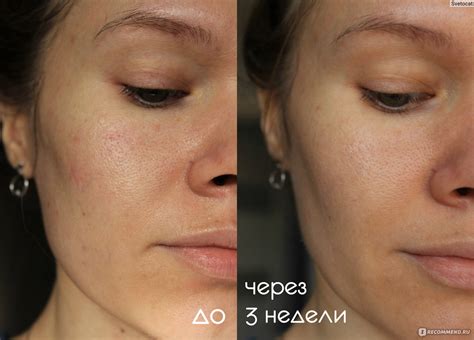 Энзимная пилинг-пудра Icon Skin Для умывания с экстрактами 7 трав (7 ...