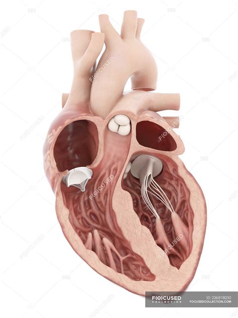 Medical illustration of artificial heart valve. — Cardiac, surgical