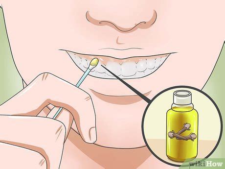 How to Reduce Gum Swelling (with Pictures) - wikiHow