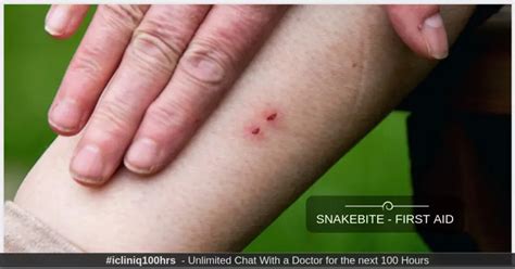 Snakebite - First Aid, Treatment, and Precautions