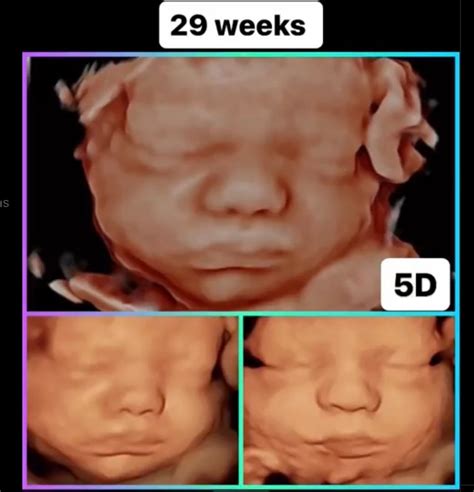 3D 4D 5D HD baby ultrasound imaging. Gender Ultrasound Sonogram. Bebe ...