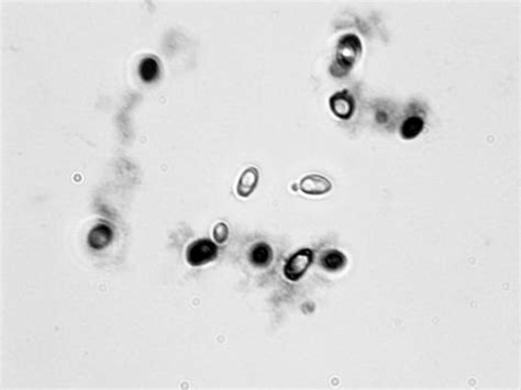 Microscopy for the Winery | Viticulture and Enology
