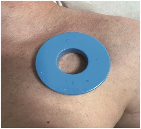 If You Are Not Sure the Pacemaker is Working, Do Not Forget the Magnet