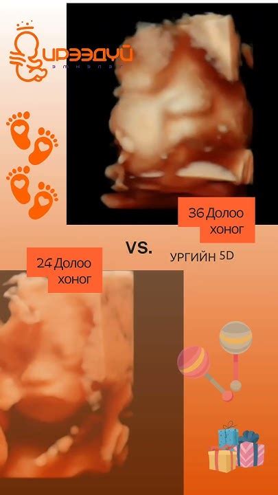 Эрүүл #ирээдүйг бид тодорхойлно. #Ирээдүй_Эмнэлэг. #Ирээдүй_Эмнэлэг_5D ...