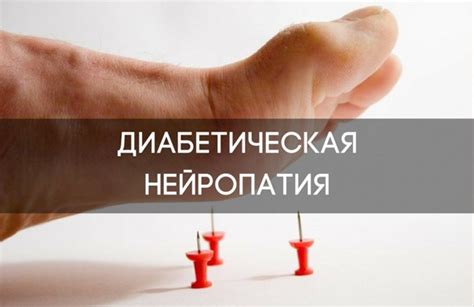 Диабетическая нейропатия. Классификация. Этиология и патогенез ...